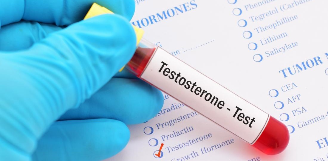 Bild für Testosteron kann Depressionen lindern